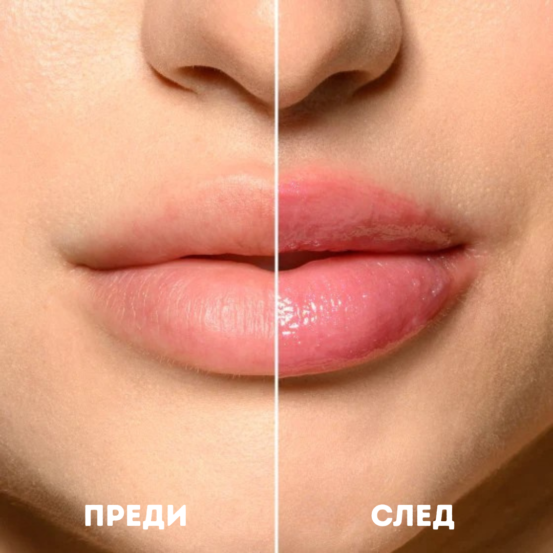 VTCOSMETICS Reedle Shot Lip Plumper