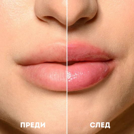 VTCOSMETICS Reedle Shot Lip Plumper